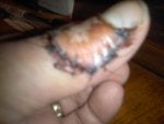 Crossbow damage to Cliff thumb.jpg